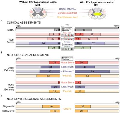 Potential thresholds of critically increased cardiac-related spinal cord motion in degenerative cervical myelopathy